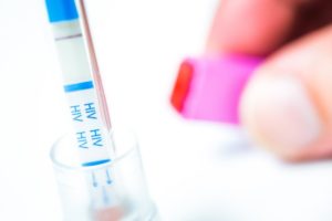 Picture of HIV test for AIDS/HIV Discrimination
